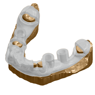 Cerrahi Planlama ve Rehber